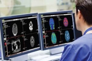 Low-Cost Radiology PACS