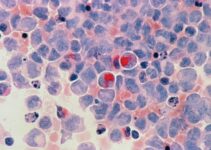 red round fruits on white and blue surface